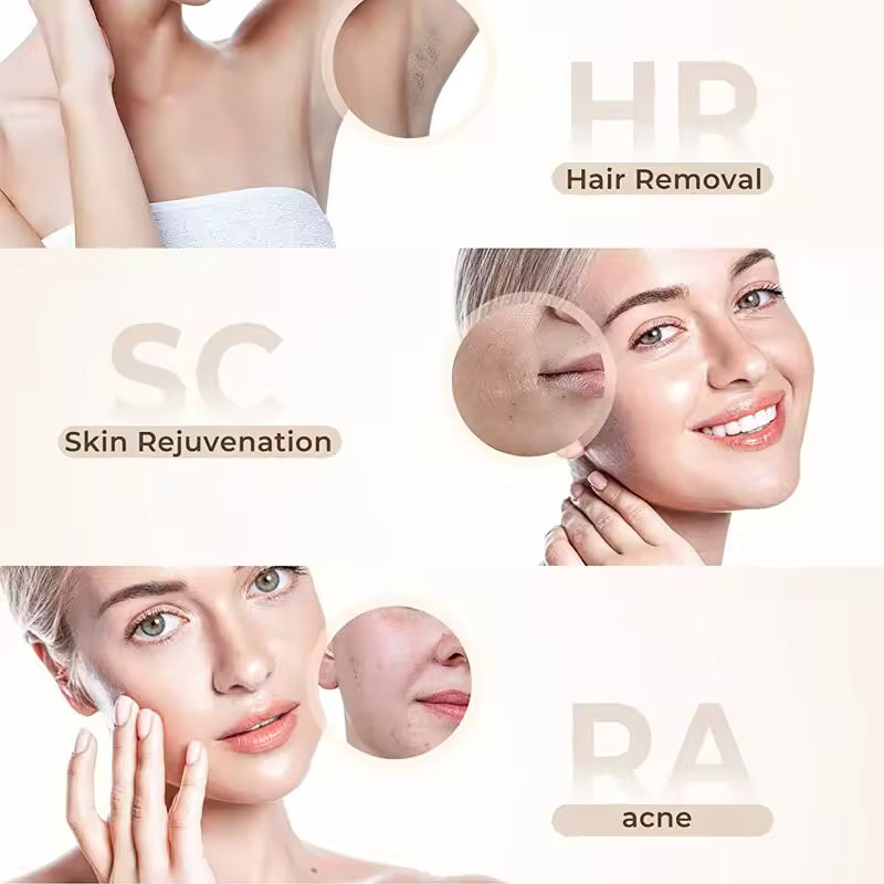 Épilateur IPL 3-en-1 – Épilation durable à domicile (visage & corps)