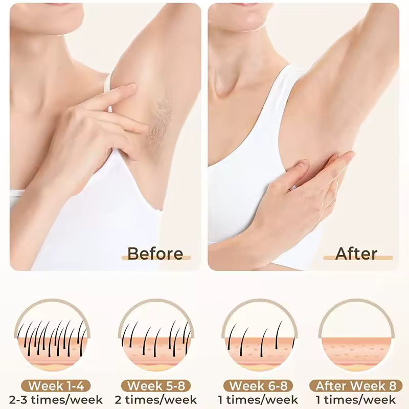 Épilateur IPL 3-en-1 – Épilation durable à domicile (visage & corps)