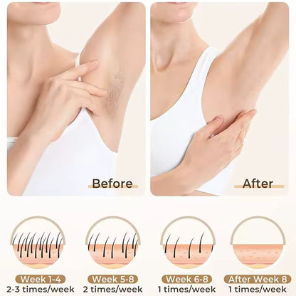 Épilateur IPL 3-en-1 – Épilation durable à domicile (visage & corps)